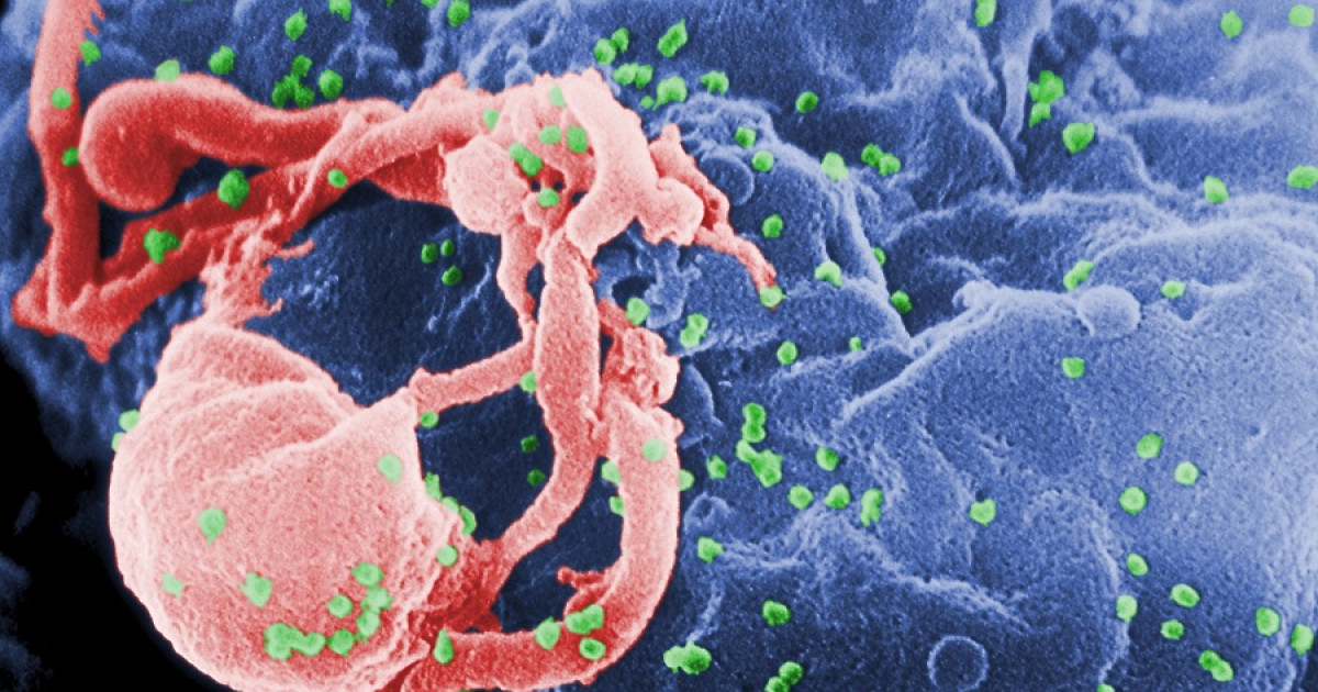 HIV, İnsan Davranışını Değiştirebilir mi?