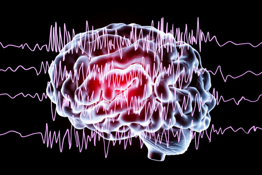 Beyin gürültüsünü simgeleyen dalgalarla beyin